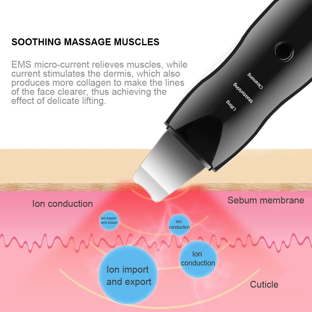 Espátula Facial Vibratoria – Limpieza de Poros y Lifting