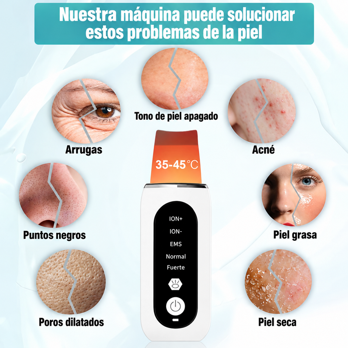 Espátula Facial Ultrasónica – Limpieza Profunda de Poros, Puntos Negros y Acné