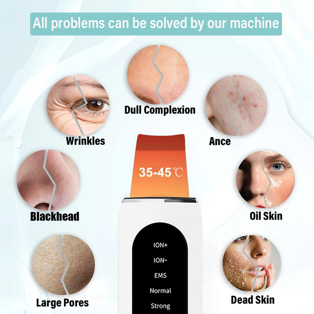 Espátula Facial Ultrasónica – Limpieza Profunda y Peeling