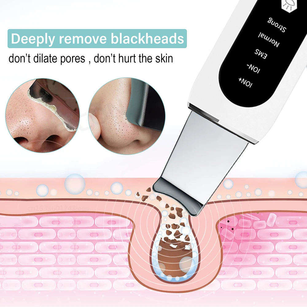 Espátula Facial Ultrasónica – Limpieza Profunda y Peeling