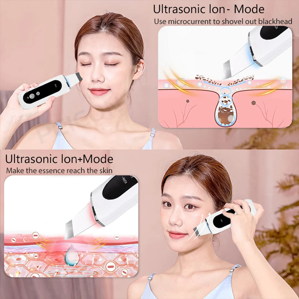 Espátula Facial Ultrasónica – Limpieza Profunda y Peeling