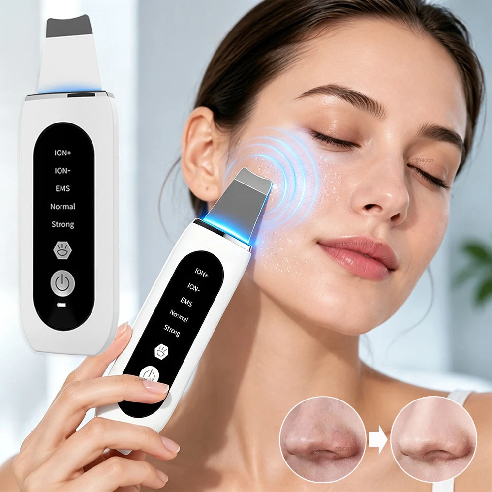 Espátula Facial Ultrasónica – Limpieza Profunda y Peeling