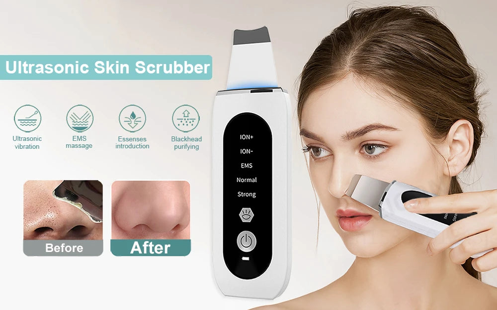 Espátula Facial Ultrasónica – Limpieza Profunda y Peeling
